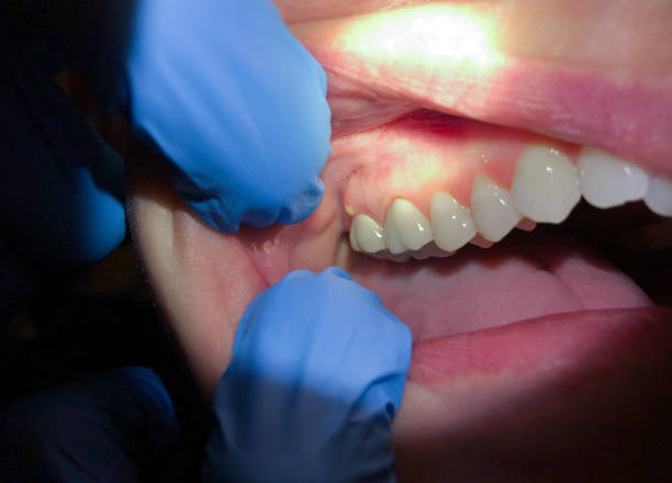 Best Urgent Dental Care for Toothache in Bells, TX